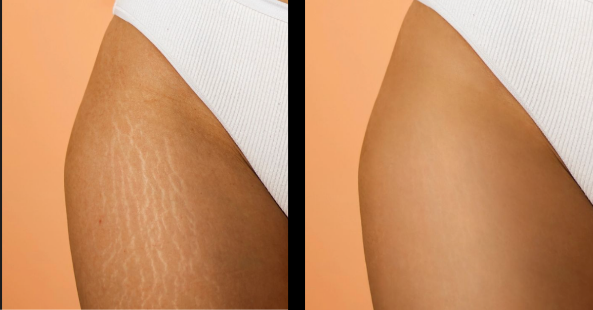 The Skin Renewal Ritual Women Are Calling Their “Self-Love Secret”