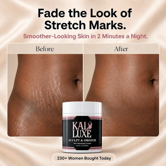 Stretch Mark Renewal Cream